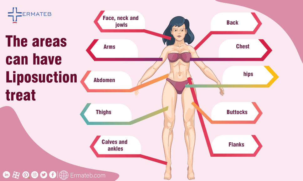 the areas can have liposuction treat